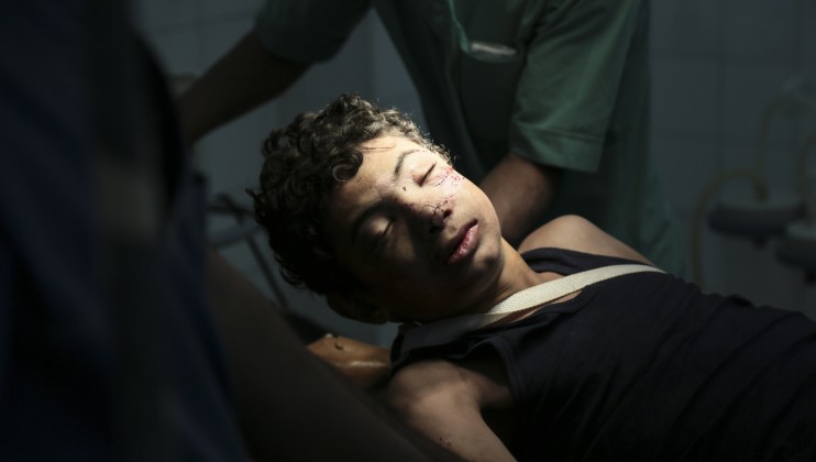 This young man was injured, suffering major facial fractures, during the fighting in Fajj Attan.